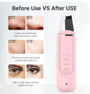 Inface Facial Cleansing Brush & Ultrasonic Ion Cleansing Skin Scrubber - Shoptabulous